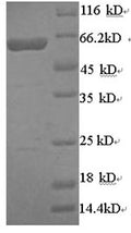 Recombinant Human Arylsulfatase B (ARSB) – Figure 1 of 1