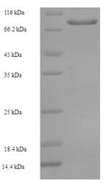 Recombinant Human Arylsulfatase G (ARSG) – Figure 1 of 1