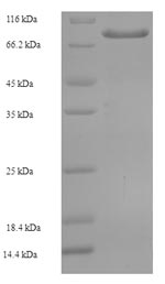 Recombinant Human Arylsulfatase G (ARSG) – Figure 1 of 1