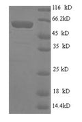 Recombinant Human GPI-linked NAD (P) (+)--arginine ADP-ribosyltransferase 1 (ART1) – Figure 1 of 1