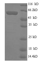 Recombinant Human GPI-linked NAD (P) (+)--arginine ADP-ribosyltransferase 1 (ART1) – Figure 1 of 1