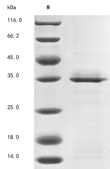 (Tris-Glycine gel) Discontinuous SDS-PAGE (reduced) with 5% enrichment gel and 15% separation gel.