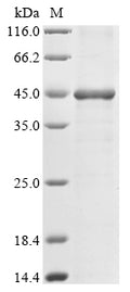 (Tris-Glycine gel) Discontinuous SDS-PAGE (reduced) with 5% enrichment gel and 15% separation gel.