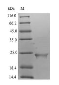 Recombinant Human Putative inactive neutral ceramidase B (ASAH2B) – Figure 1 of 1