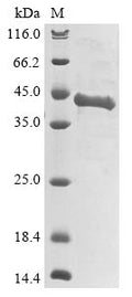 (Tris-Glycine gel) Discontinuous SDS-PAGE (reduced) with 5% enrichment gel and 15% separation gel.
