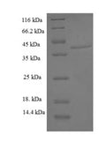 Recombinant Human Aspartyl/asparaginyl beta-hydroxylase (ASPH), partial – Figure 1 of 1