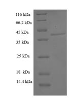 Recombinant Human Aspartyl/asparaginyl beta-hydroxylase (ASPH), partial – Figure 1 of 1