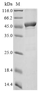 (Tris-Glycine gel) Discontinuous SDS-PAGE (reduced) with 5% enrichment gel and 15% separation gel.