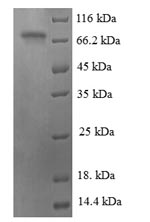 Recombinant Human Cyclic AMP-dependent transcription factor ATF-2 (ATF2) – Figure 1 of 1