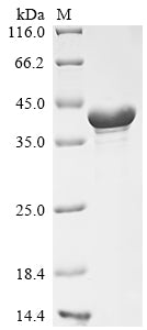 (Tris-Glycine gel) Discontinuous SDS-PAGE (reduced) with 5% enrichment gel and 15% separation gel.