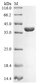 (Tris-Glycine gel) Discontinuous SDS-PAGE (reduced) with 5% enrichment gel and 15% separation gel.