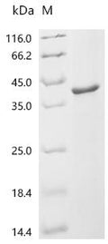 (Tris-Glycine gel) Discontinuous SDS-PAGE (reduced) with 5% enrichment gel and 15% separation gel.