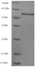 Recombinant Human Sarcoplasmic/endoplasmic reticulum calcium ATPase 2 (ATP2A2), partial – Figure 1 of 1