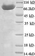 Recombinant Mouse ATP synthase subunit beta, mitochondrial (Atp5b) – Figure 1 of 1