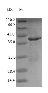 Recombinant Human Renin receptor (ATP6AP2) – Figure 1 of 1