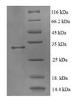 Recombinant Human ATP synthase mitochondrial F1 complex assembly factor 2 (ATPAF2) – Figure 1 of 1