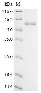 Recombinant Human Aurora kinase A (AURKA) – Figure 1 of 1