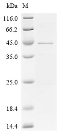 (Tris-Glycine gel) Discontinuous SDS-PAGE (reduced) with 5% enrichment gel and 15% separation gel.