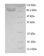 Recombinant Human Breast carcinoma-amplified sequence 1 (BCAS1) – Figure 1 of 1