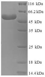 Recombinant Human Branched-chain-amino-acid aminotransferase, mitochondrial (BCAT2) – Figure 1 of 1