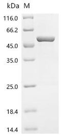 Recombinant Mouse 2-oxoisovalerate dehydrogenase subunit alpha, mitochondrial (Bckdha) – Figure 1 of 1