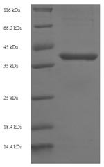 Recombinant Human B-cell lymphoma/leukemia 10 (BCL10) – Figure 1 of 1