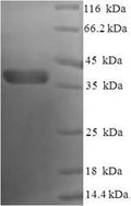Recombinant Human Bcl-2-like protein 1 (BCL2L1), partial – Figure 1 of 1