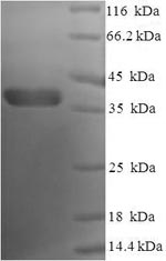 Recombinant Human Bcl-2-like protein 1 (BCL2L1), partial – Figure 1 of 1