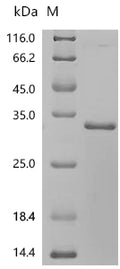 (Tris-Glycine gel) Discontinuous SDS-PAGE (reduced) with 5% enrichment gel and 15% separation gel.
