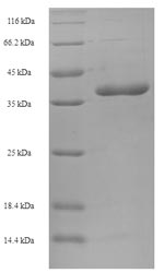 Recombinant Human Bcl-2-like protein 11 (BCL2L11) – Figure 1 of 1
