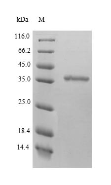 Recombinant Human D-beta-hydroxybutyrate dehydrogenase, mitochondrial (BDH1) – Figure 1 of 1