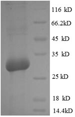 (Tris-Glycine gel) Discontinuous SDS-PAGE (reduced) with 5% enrichment gel and 15% separation gel.