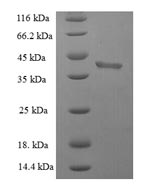 Recombinant Human BH3-interacting domain death agonist (BID) – Figure 1 of 1