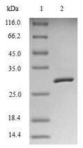 (Tris-Glycine gel) Discontinuous SDS-PAGE (reduced) with 5% enrichment gel and 15% separation gel.