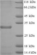 Recombinant Mouse Baculoviral IAP repeat-containing protein 5 (Birc5) – Figure 1 of 1