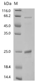 (Tris-Glycine gel) Discontinuous SDS-PAGE (reduced) with 5% enrichment gel and 15% separation gel.