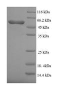 Recombinant Human Bone morphogenetic protein receptor type-1A (BMPR1A), partial – Figure 1 of 1