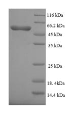 Recombinant Human Bone morphogenetic protein receptor type-1A (BMPR1A), partial – Figure 1 of 1