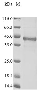 (Tris-Glycine gel) Discontinuous SDS-PAGE (reduced) with 5% enrichment gel and 15% separation gel.