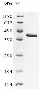 (Tris-Glycine gel) Discontinuous SDS-PAGE (reduced) with 5% enrichment gel and 15% separation gel.