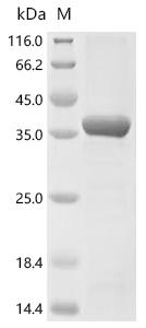 (Tris-Glycine gel) Discontinuous SDS-PAGE (reduced) with 5% enrichment gel and 15% separation gel.
