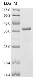 (Tris-Glycine gel) Discontinuous SDS-PAGE (reduced) with 5% enrichment gel and 15% separation gel.