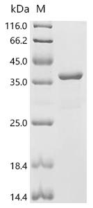 (Tris-Glycine gel) Discontinuous SDS-PAGE (reduced) with 5% enrichment gel and 15% separation gel.