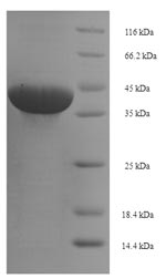 Recombinant Human Butyrophilin subfamily 3 member A1 (BTN3A1), partial – Figure 1 of 1