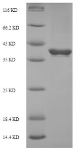 Recombinant Human Butyrophilin subfamily 3 member A2 (BTN3A2), partial – Figure 1 of 1