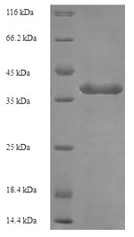 Recombinant Human Butyrophilin subfamily 3 member A3 (BTN3A3), partial – Figure 1 of 1