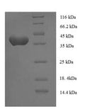 Recombinant Human Anaphase-promoting complex subunit 15 (ANAPC15) – Figure 1 of 1