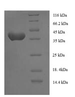 Recombinant Human Anaphase-promoting complex subunit 15 (ANAPC15) – Figure 1 of 1