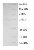 Recombinant Human Immortalization up-regulated protein (IMUP) – Figure 1 of 1