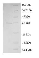 Recombinant Human Immortalization up-regulated protein (IMUP) – Figure 1 of 1